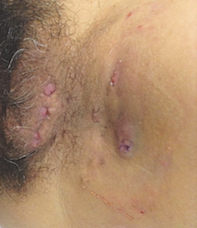 Fig 1.