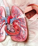 © BAYER. PULMONARY ARTERIAL HYPERTENSION
